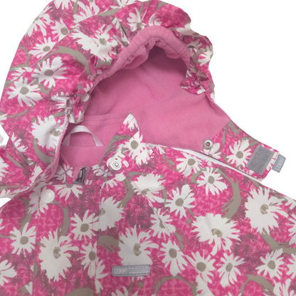 removable hood